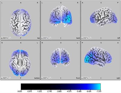 Effects of transcranial direct current stimulation on brain activity and cortical functional connectivity in children with autism spectrum disorders